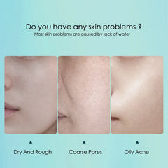 10pcs Hyaluronic Acid Hydrating Facial Mask Sheet Masks for Face