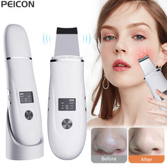 Appareil de nettoyage ultrasonique pour le visage – Outil de peeling facial en profondeur