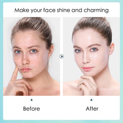 10pcs Hyaluronic Acid Hydrating Facial Mask Sheet Masks for Face